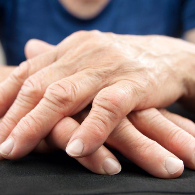 magas vérnyomás rheumatoid arthritisben